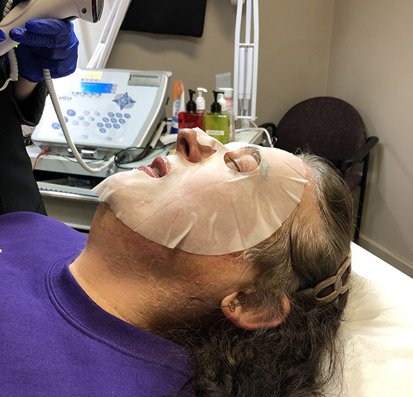 GALVANIC FACIAL